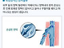 하지정맥류 - 정맥의 흐름 & 종아리 근육(제2의 심장)