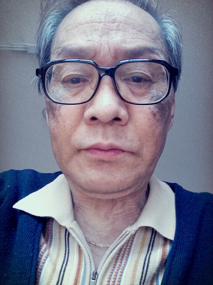 블로그 이미지